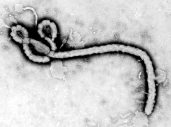 Smrtiaci vírus ebola, na ktorý stále nemáme účinný liek
