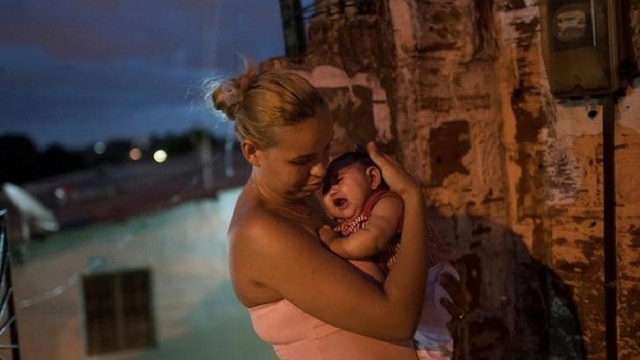 Brazílska matka si túli dieťa narodené s mikrocefáliou 
