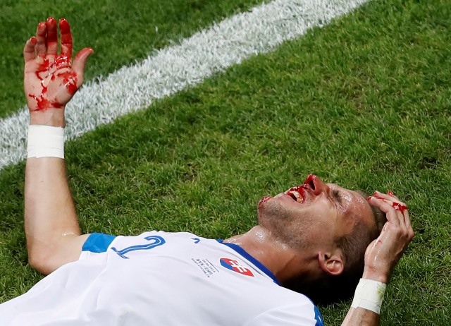 Slovenský futbalista Peter Pekarík leží zakrvavený na trávniku počas zápasu B-skupiny na majstrovstvách Európy vo futbale medzi Slovenskom a Anglickom
