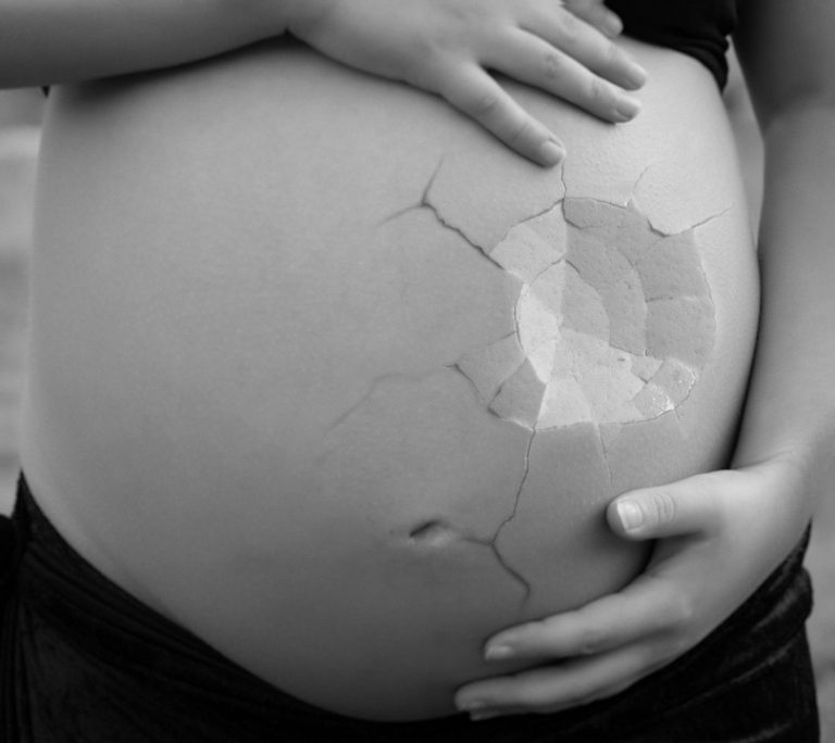 interupcia potrat tehotenstvo