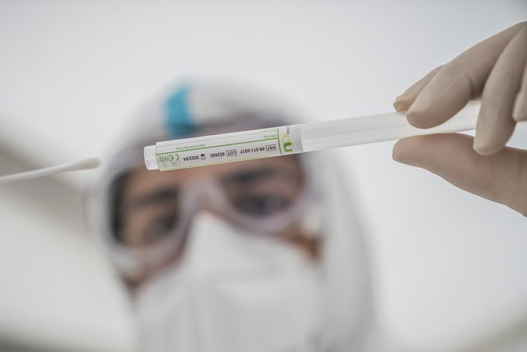 PCR test testovanie ochorenie