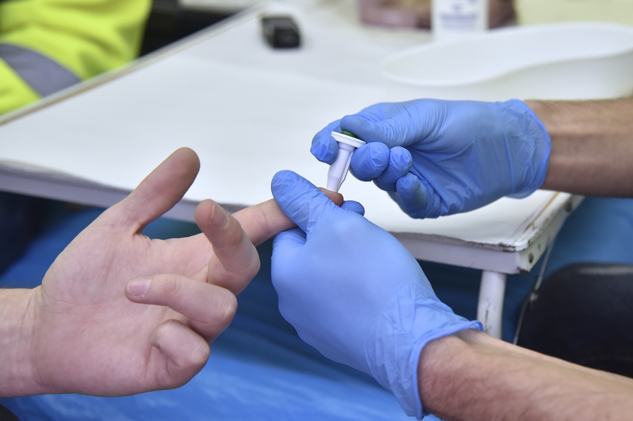 HIV mobilná poradňa